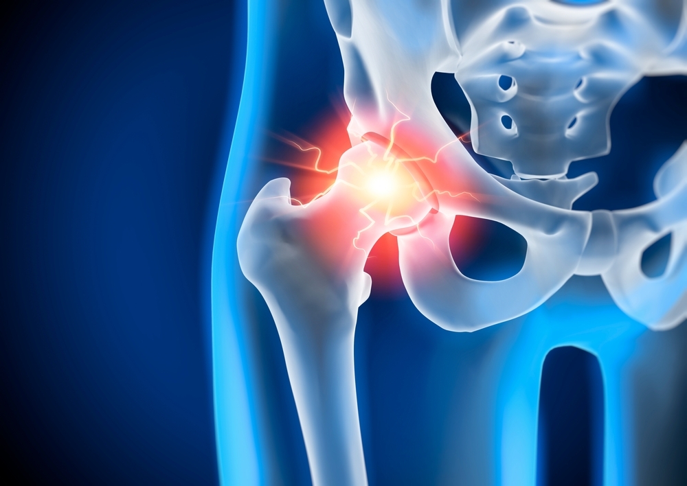 Αρθροσκόπηση ισχίου - δικηγορικό γραφείο θεσσαλονίκη
